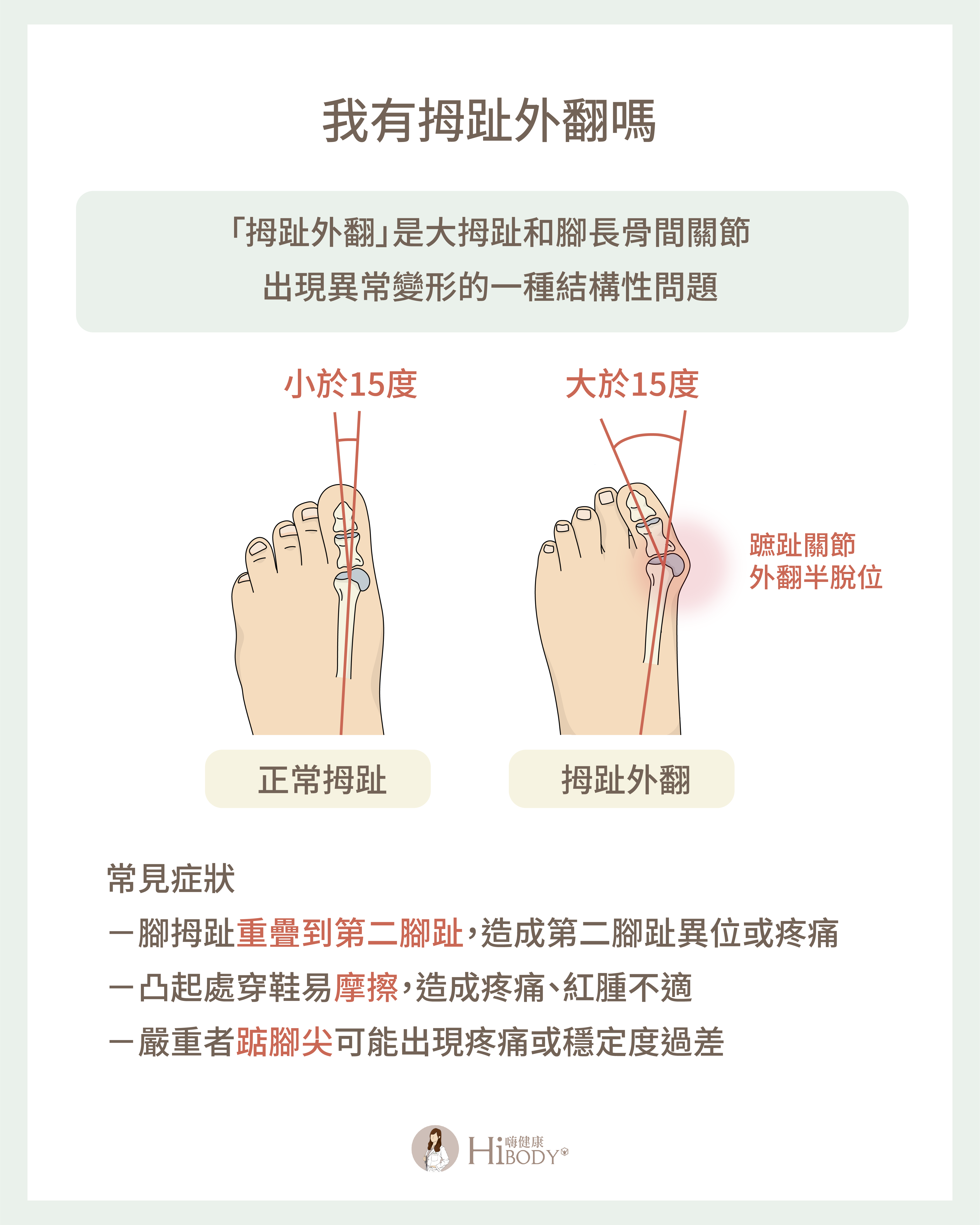拇趾外翻竟然和扁平足有關?物理治療師分享 4 招改善拇趾外翻及扁平足困擾 HiBODY 嗨健康|物理治療