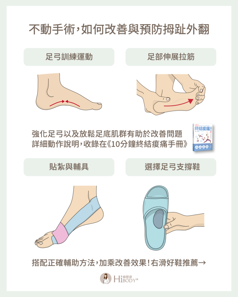 拇趾外翻竟然和扁平足有關?物理治療師分享 4 招改善拇趾外翻及扁平足困擾 HiBODY 嗨健康|物理治療